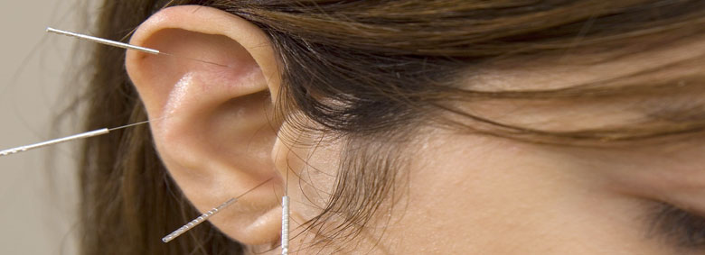 akupunktúra